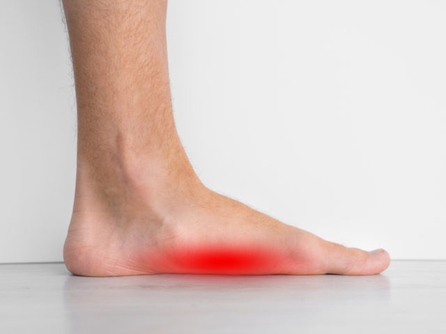 土踏まずが痛い原因は足底腱膜炎？セルフチェックや対処法を解説